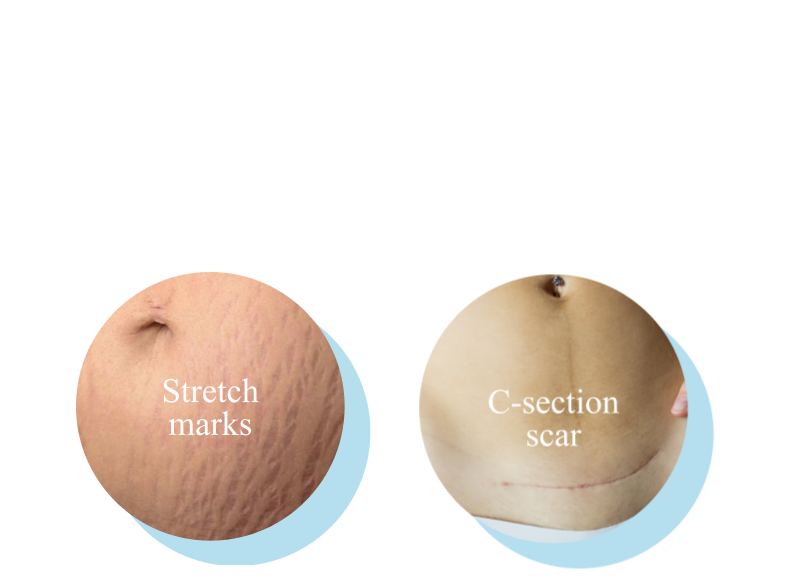 Juvelook